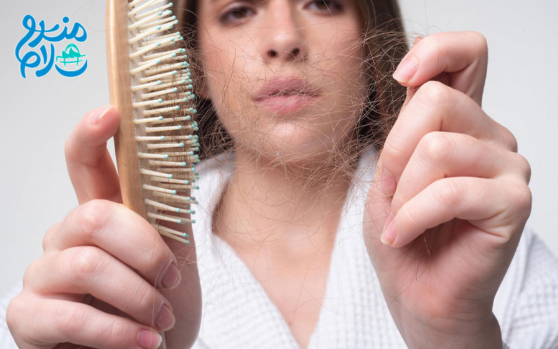 استرس چگونه باعث ریزش مو می شود؟